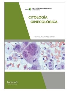 Citología Ginecológica