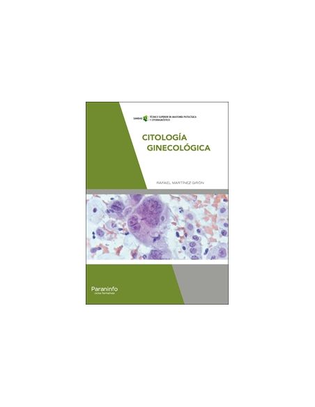 Citología Ginecológica